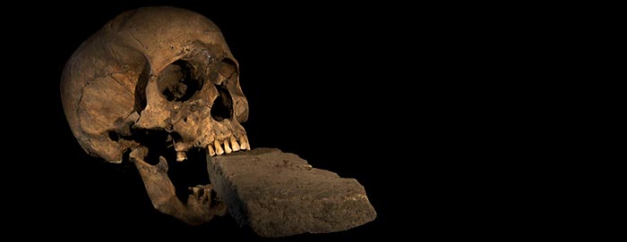 Le crâne retrouvé à Venise, une brique enfoncée dans la bouche