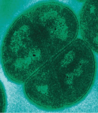 La face du Deinococcus radiodurans dont l'extrême capacité de régénération d'ADN est une source d'inspiration pour les scientifiques. 